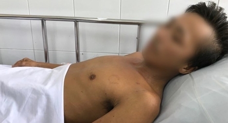 “Kỳ tích” cứu sống người đàn ông bị rắn hổ mang cắn của Bệnh viện Chợ Rẫy